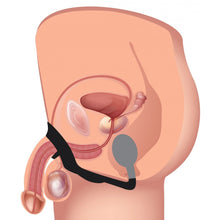Load image into Gallery viewer, XR Alpha Pro 10X P Bomb Cock and Ball Ring With Anal Plug
